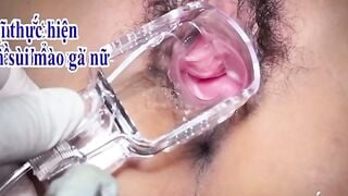 Cận cảnh khám phụ khoa nữ vn u45