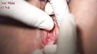 Khám phụ khoa cô u60