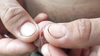 Thả giun vào cu 2