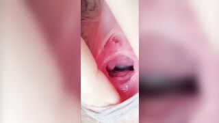 Lồn cận cảnh
