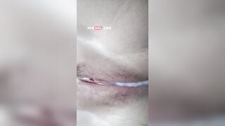 Show cận cảnh lồn múp ngập tinh