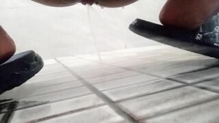 Đái bằng lỗ đít