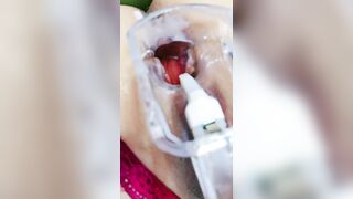GÁI MÚP LỒN RỘNG THỦ DÂM 9