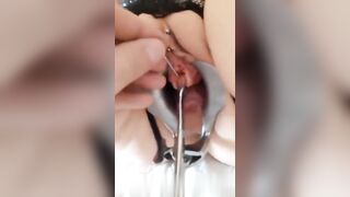 Video hiếm, cái này là vòng xỏ lỗ niệu đạo, quá quái dị nặng đô.